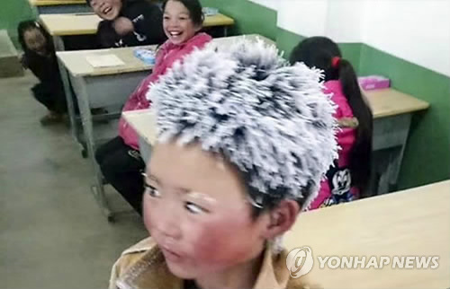 `눈송이 소년` 울린 중국…돕겠다 약속하더니 "나몰라라"