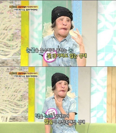 '선풍기 아줌마' 한혜경씨, 15일 별세…향년 57세