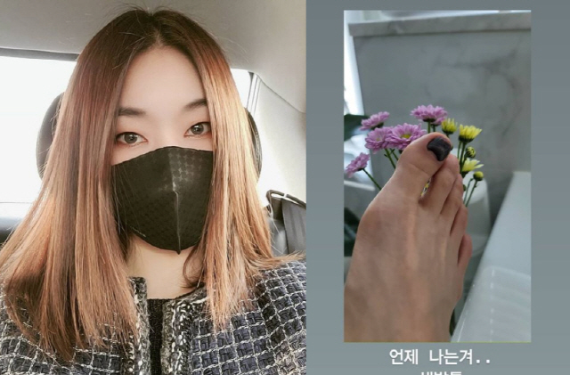 한혜진, 새까맣게 멍든 발톱 '패디큐어인줄'