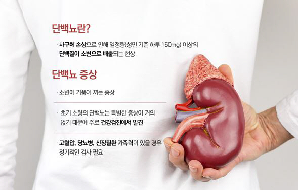 소변에서 거품이? 단백뇨 증상과 치료는?