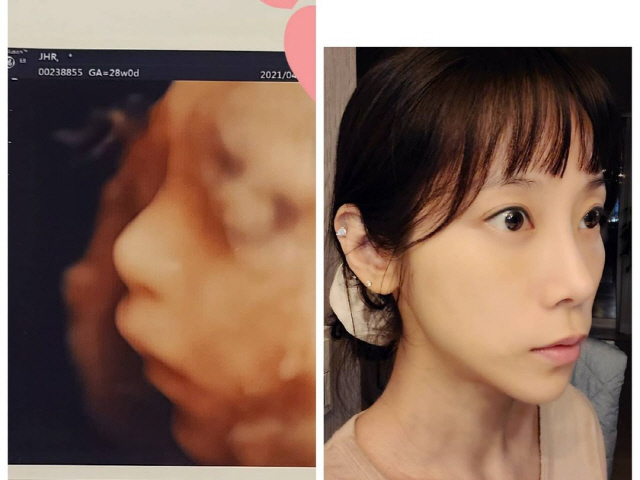 '예비맘' 조민아, 똑닮은 초음파 사진 공개…"딱 제 아들 같죠"