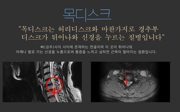 고개숙인 당신, 목엔 18kg 하중 부담