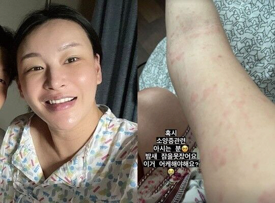 배윤정, 산후소양증 고백 "응급실서 주사맞고 약 처방받아"