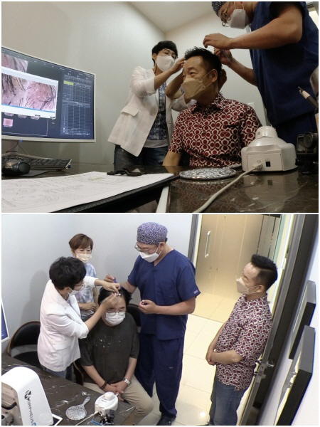 최양락, 모발이식센터서 절규한 사연 "난 대머리가 아냐!" 절규('1호가…