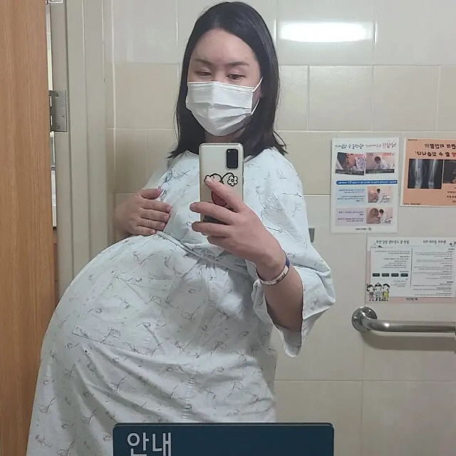'104kg' 황신영, 세쌍둥이 출산 임박 결국 입원…"주말에 수술할 수…