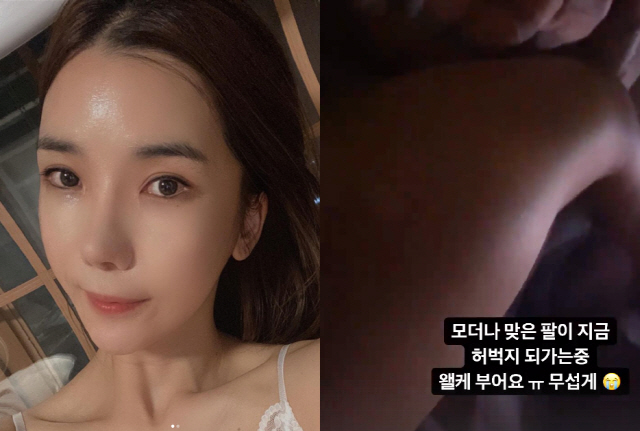 '김동성♥' 인민정, 모더나 2차 접종 후기…"팔이 허벅지가 됐다"