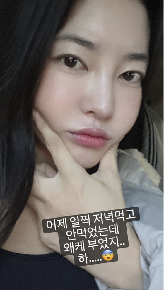 '최우성♥' 김윤지, 5kg 쪄 부었다는 얼굴 맞아?...'얼빡샷'에도 …