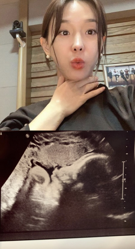 '♥세무사' 이지혜, 초음파 사진에 흐뭇 "아기 몸무게 3.1kg, 2주…