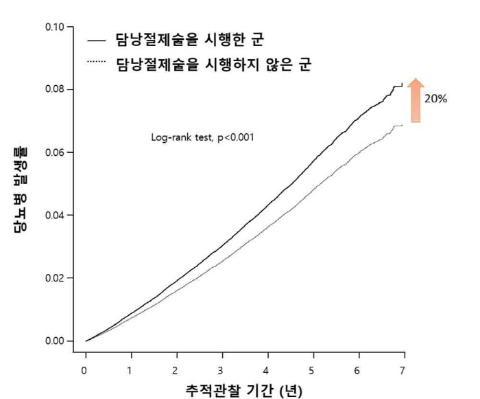 "담낭절제술 시행후 당뇨병 발병 위험 20% 증가"