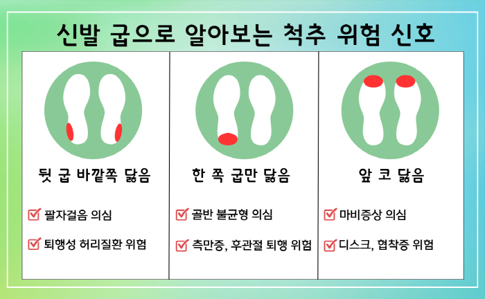 신발 굽 닳는 걸 보면 척추병 보인다…앞쪽 닳으면 병원가야