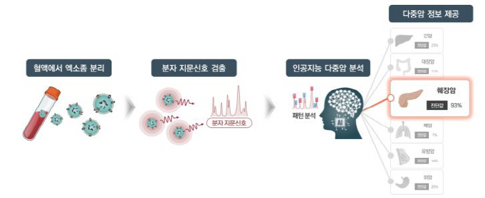 "혈액 검사로 6대 암 조기 진단…정확도 97%"