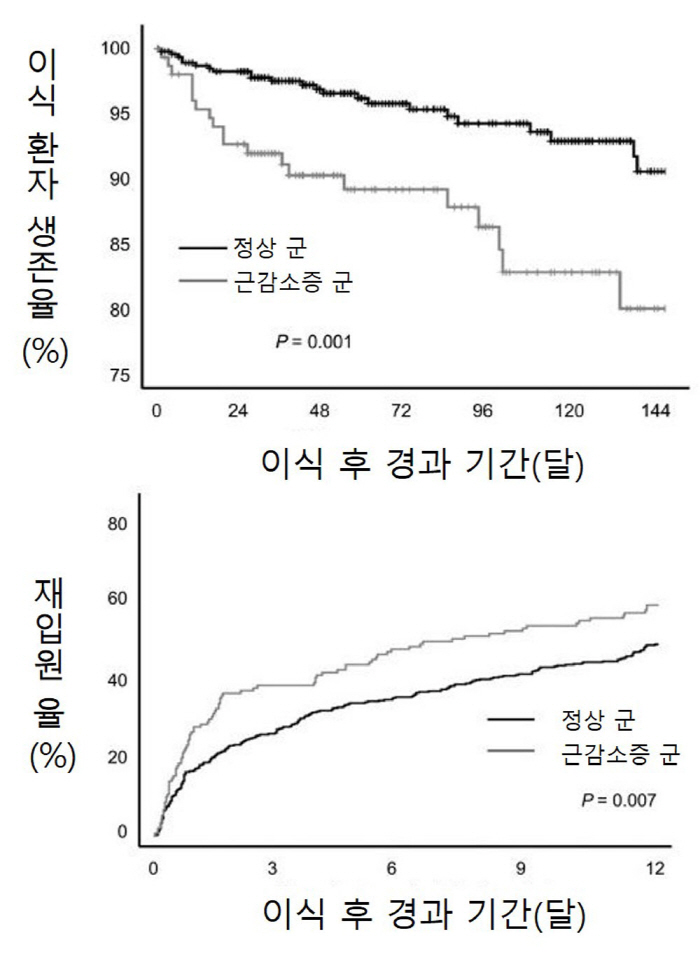 "근감소증, 신장이식 후 사망률 최대 2.4배 높아"…1개월내 재입원율도…