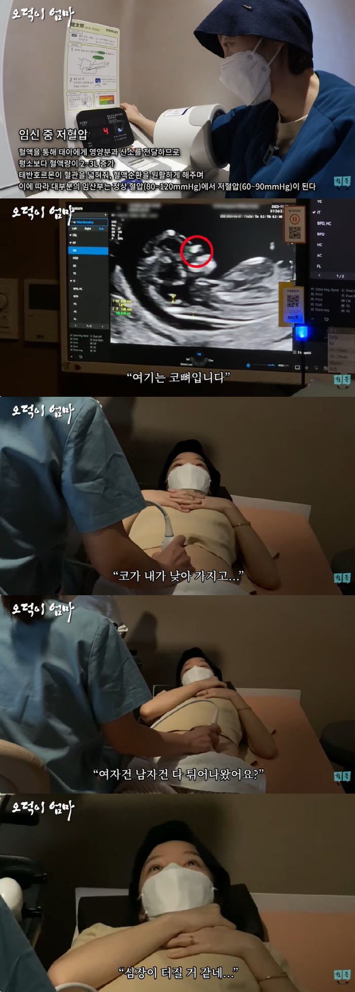 '김용건 며느리' 황보라, 아기 기형아 검사에 잔뜩 긴장 "심장 터질 거…