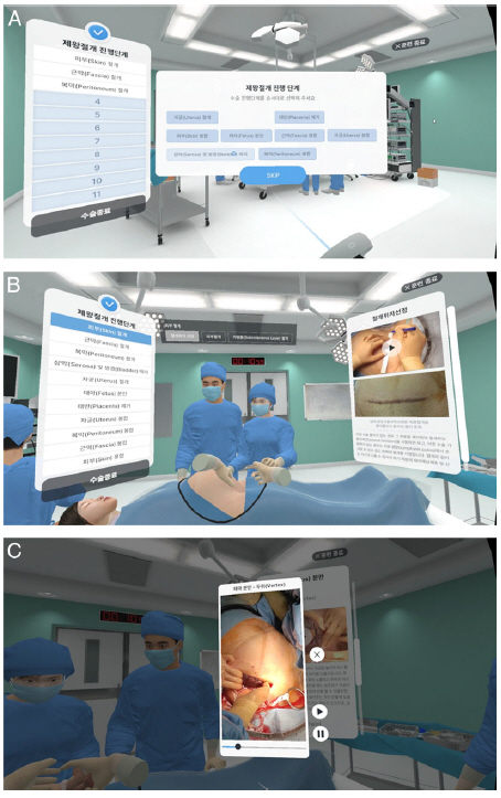 제왕절개 수술기법 숙달에 'VR' 도움…의학 교육 도구 효과 확인