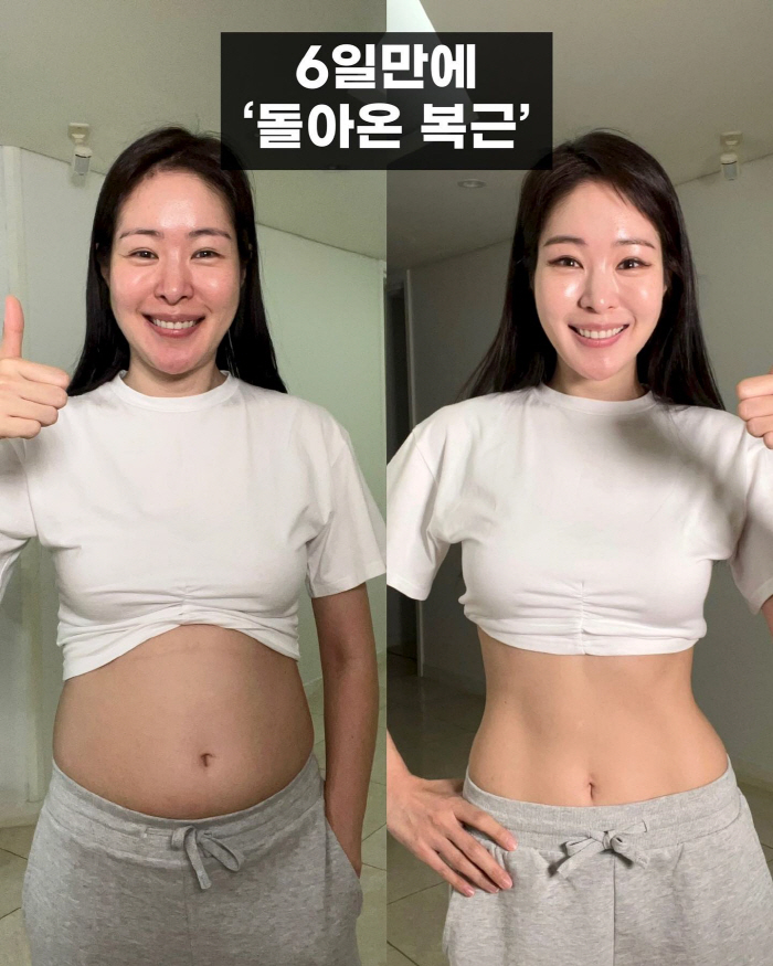 "6일만에 5kg 감량"…'김태현♥' 미자 "급진급빠 완료, 배 완전 홀…