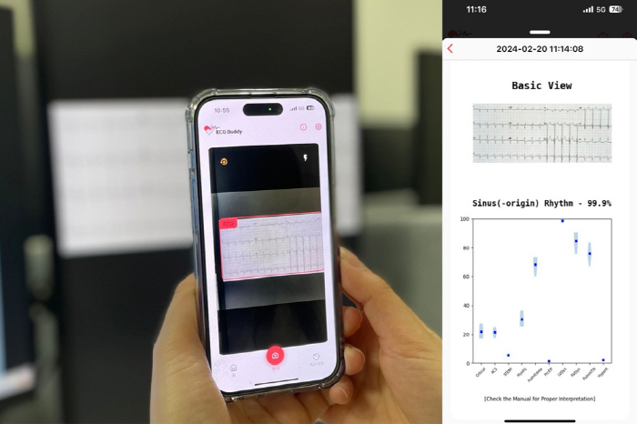 스마트폰으로 심전도 이미지 분석…인공지능모델 식약처 인증