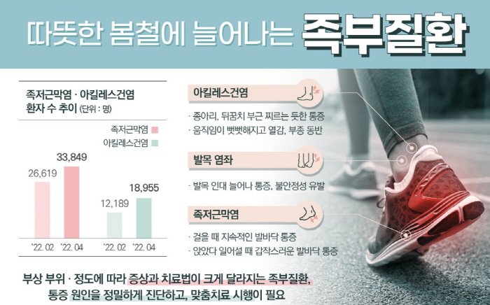 봄철 족저근막염·발목 염좌 위험 커지는 이유