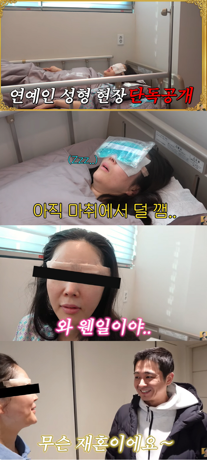 장영란, ★ 최초 성형 '비포&애프터' 공개 "25년만 6번째 수술, 고…