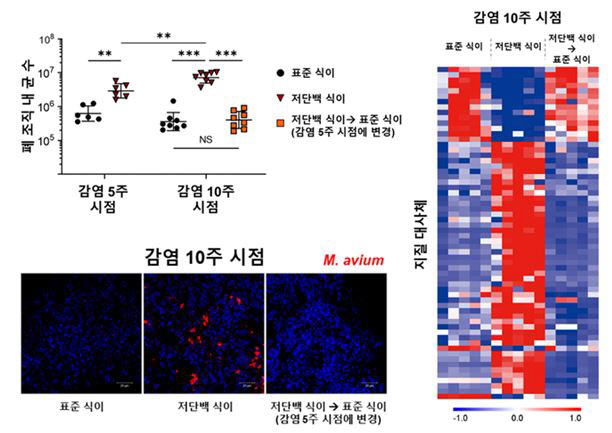 비결핵 항산균 폐질환 환자 질병 악화 메커니즘 규명…새 치료 전략 기대