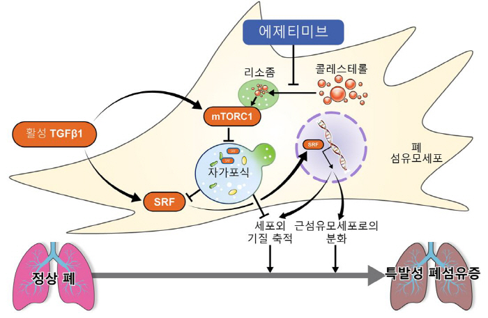 항콜레스테롤 약제 '에제티미브', 폐섬유증 진행 억제…사망 위험 최대 6…