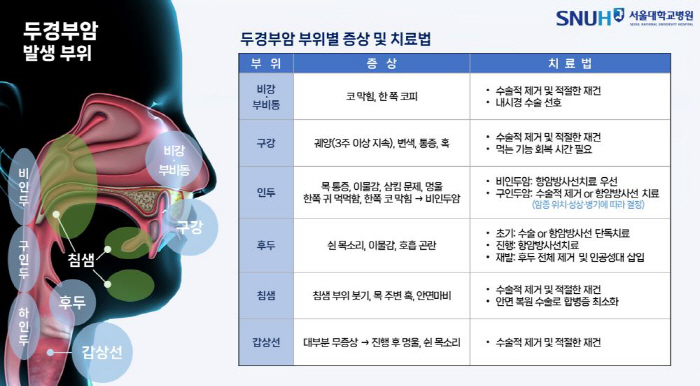 [두경부암 Q&A] 목의 혹·쉰목소리·입안 궤양 땐 의심…흡연·음주·HP…