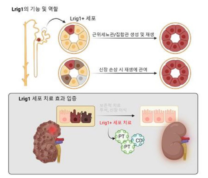 말기콩팥병 세포치료제 개발 가능성 확인…줄기세포 표지자 발굴 성공