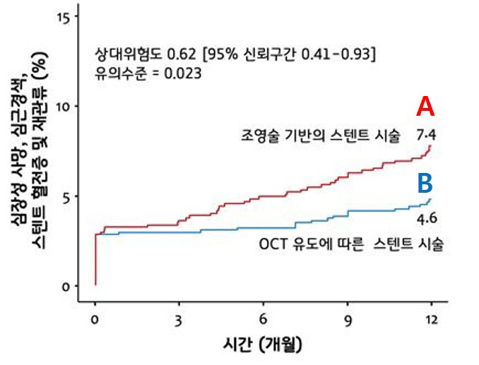 '복잡한 관상동맥 질환', 광간섭단층촬영으로 예후 개선