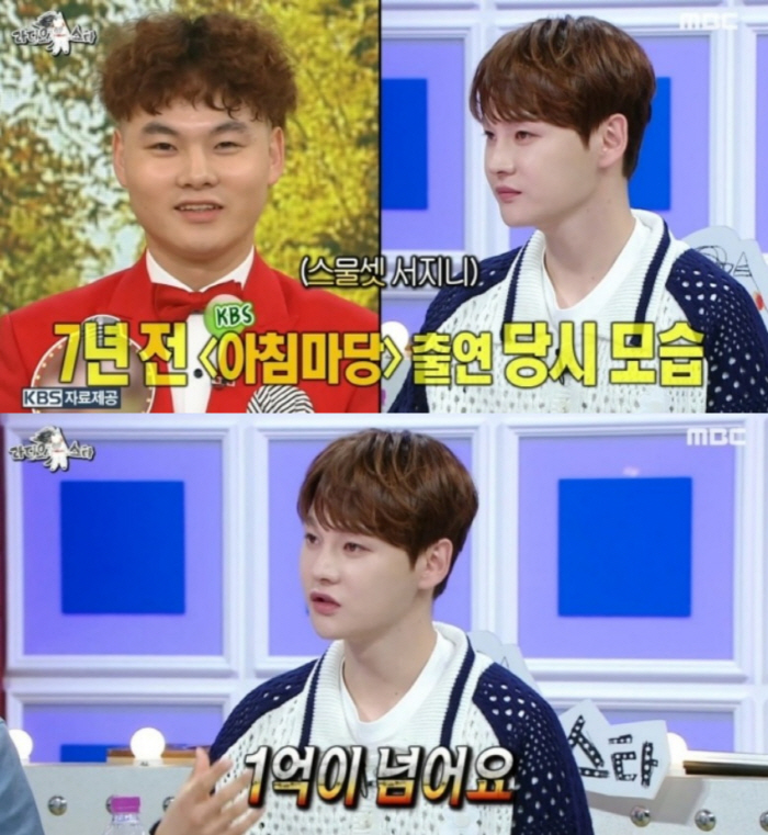 [SC리뷰] 눈 3회, 코 1회에 모발이식까지? 박서진 "난 '노력형 미…