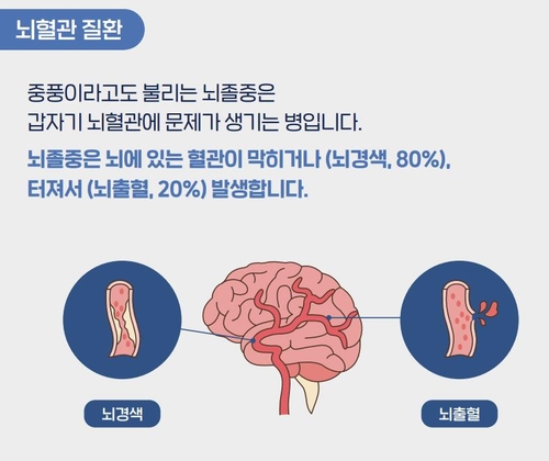 오늘 '세계 뇌졸중의 날'…"예방·치료 5가지 실천수칙 지켜야"