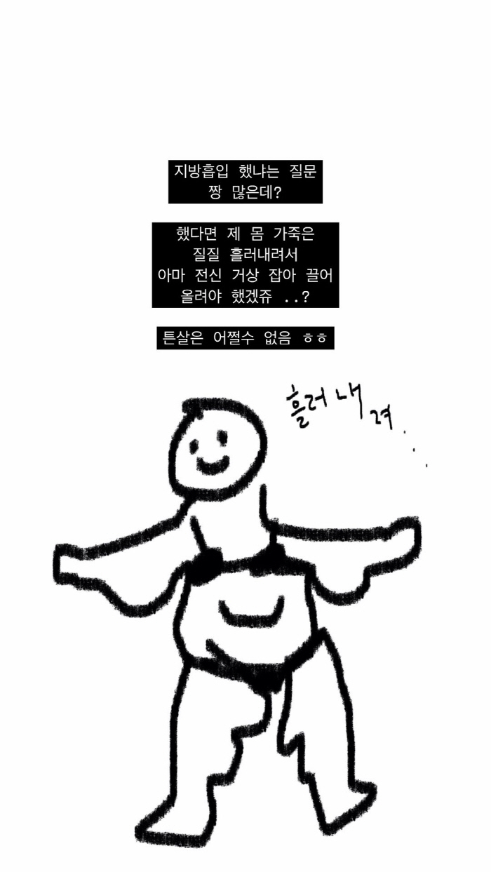 '49kg 감량' 최준희, 지방흡입 의혹 부인 "했으면 몸 가죽 질질 흘…