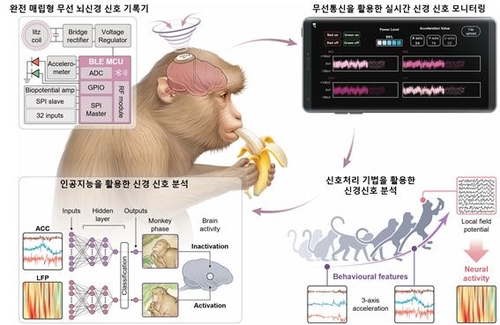 DGIST "무선 뇌신경 신호기록기 개발…난치성 뇌질환 치료 기여"