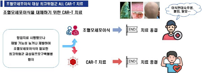 서울대병원, 급성림프모구백혈병 소아청소년 환자 CAR-T 치료 확대