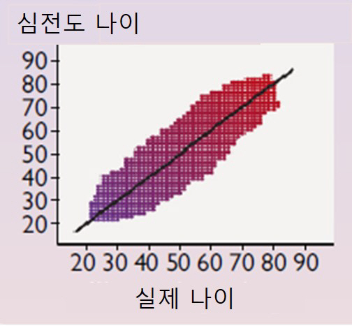 AI로 심방세동 위험 예측…다른 심장질환에도 활용 기대