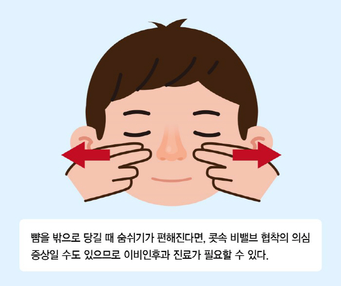 콧속 공기 통로 '비밸브' 협착 진단 새 기준 발표