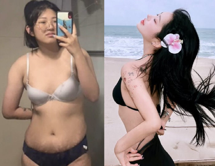 '96kg→49kg' 최준희, 뼈말라 비키니 몸매.."눈·코 이어 양악 …