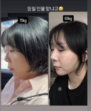 허안나, '75kg→69kg' 감량 후 눈에 띄게 달라진 턱선 