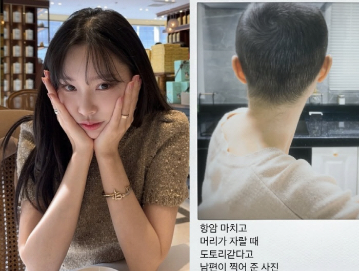 '암투병' 이솔이, 항암 후 짧아진 머리+암수술 당시 공개 "이제야 밝혀…