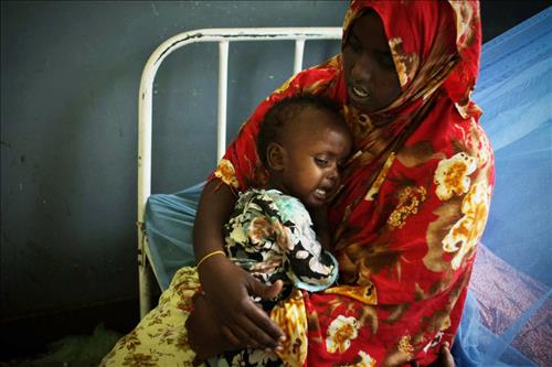 "소말리아 어린이 5만8천여명 가뭄에 굶어 죽을 판"